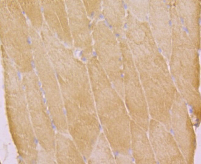 KV1.5 (KCNA5) Antibody in Immunohistochemistry (Paraffin) (IHC (P))