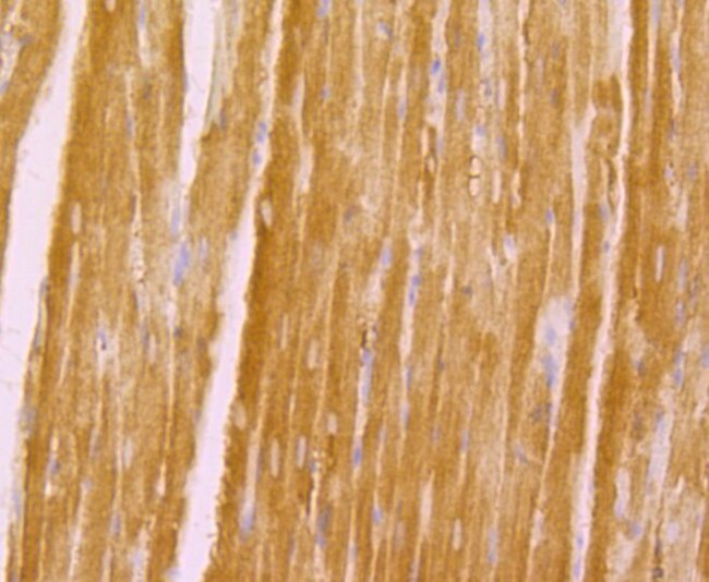 KV1.5 (KCNA5) Antibody in Immunohistochemistry (Paraffin) (IHC (P))