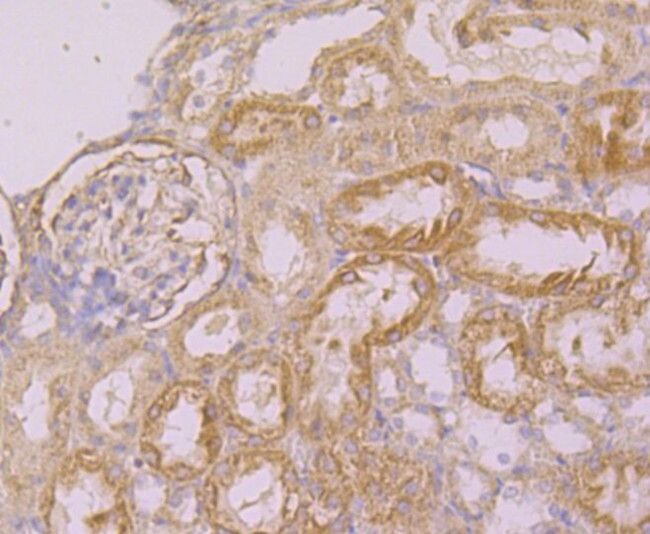 KIF11 Antibody in Immunohistochemistry (Paraffin) (IHC (P))