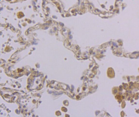 KIF11 Antibody in Immunohistochemistry (Paraffin) (IHC (P))