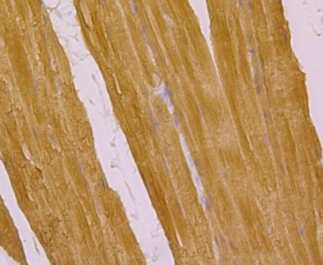 ATP2A1 Antibody in Immunohistochemistry (Paraffin) (IHC (P))