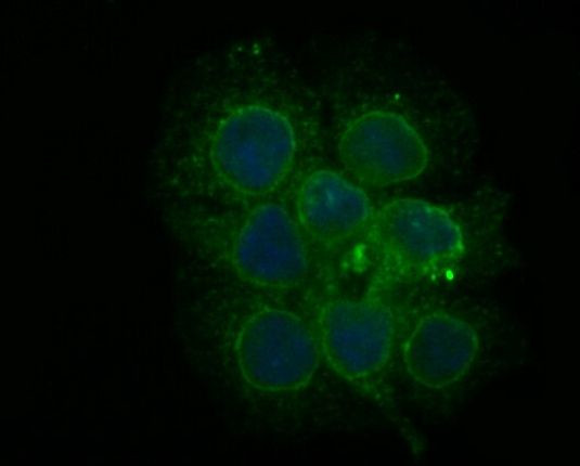 PHF8 Antibody in Immunocytochemistry (ICC/IF)