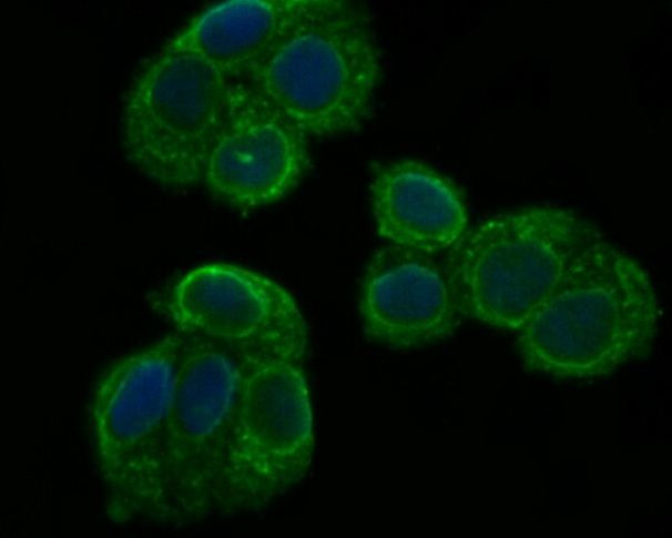 PHF8 Antibody in Immunocytochemistry (ICC/IF)