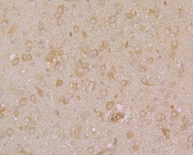 PHF8 Antibody in Immunohistochemistry (Paraffin) (IHC (P))