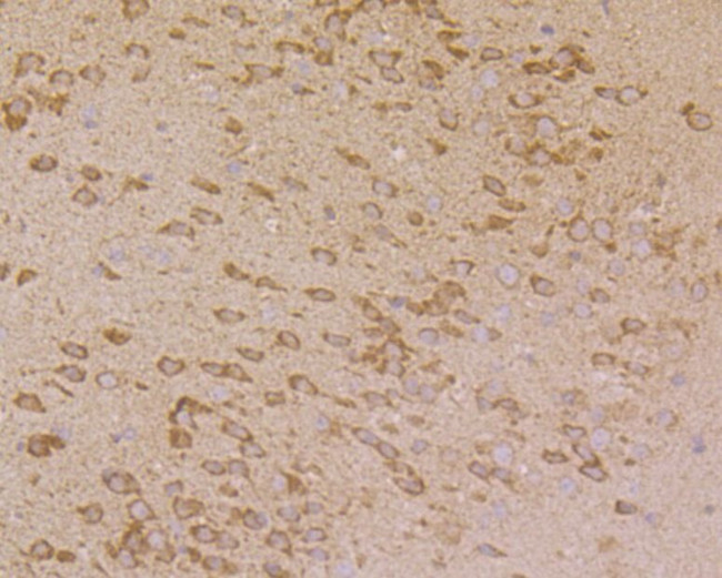 PHF8 Antibody in Immunohistochemistry (Paraffin) (IHC (P))