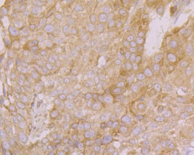 PHF8 Antibody in Immunohistochemistry (Paraffin) (IHC (P))