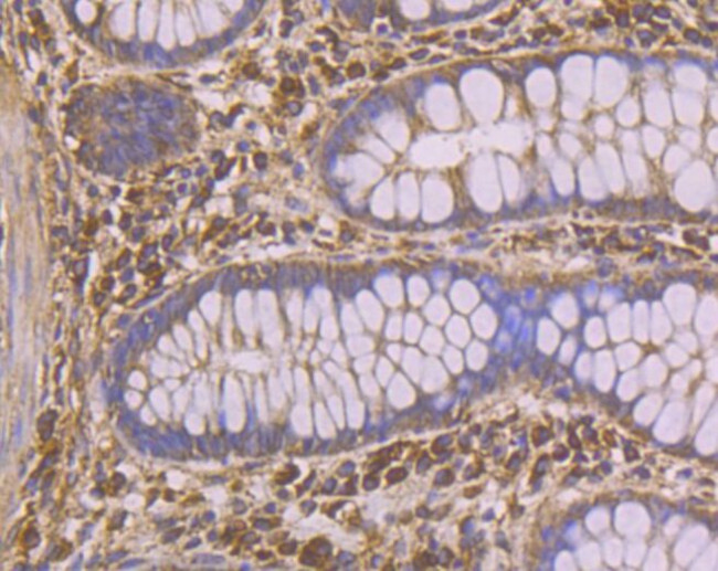 PHF8 Antibody in Immunohistochemistry (Paraffin) (IHC (P))