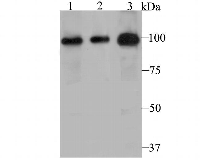 PHF8 Antibody in Western Blot (WB)