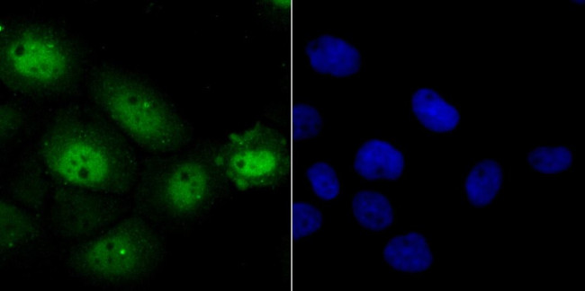 NFIC Antibody in Immunocytochemistry (ICC/IF)