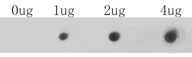 CaV1.2 Antibody in Dot Blot (DB)