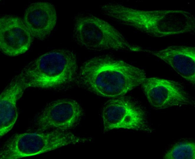 CaV1.2 Antibody in Immunocytochemistry (ICC/IF)