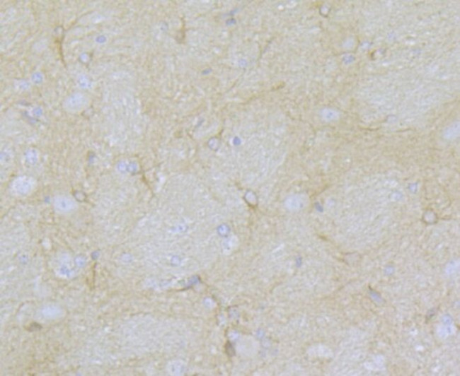 CaV1.2 Antibody in Immunohistochemistry (Paraffin) (IHC (P))