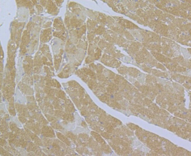 CaV1.2 Antibody in Immunohistochemistry (Paraffin) (IHC (P))