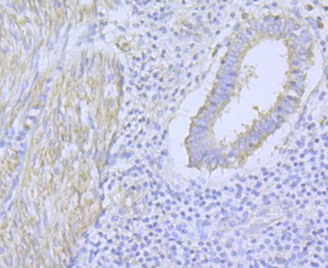 CaV1.2 Antibody in Immunohistochemistry (Paraffin) (IHC (P))