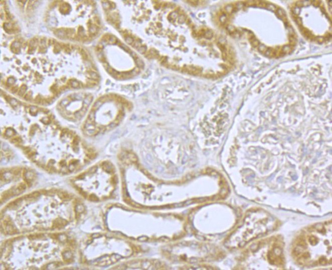 CaV1.2 Antibody in Immunohistochemistry (Paraffin) (IHC (P))