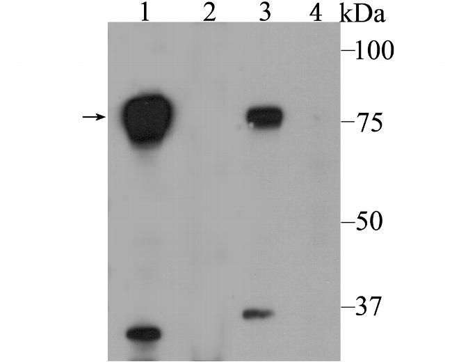 HEC1 Antibody in Western Blot (WB)