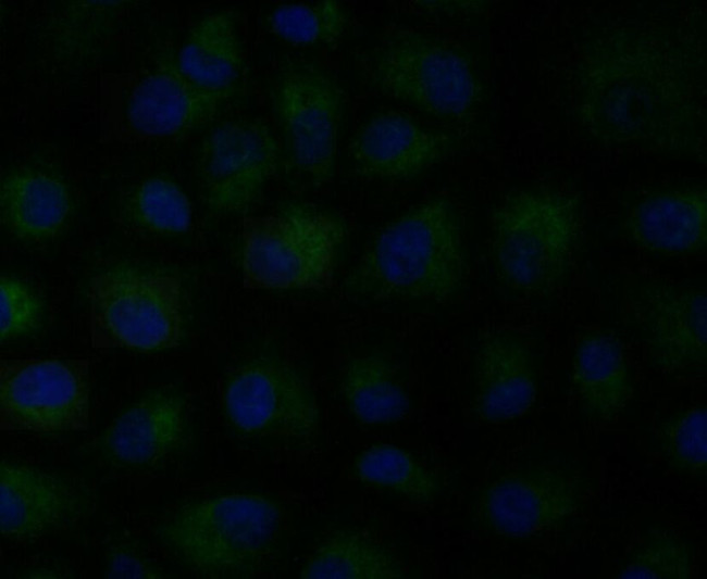 MCU Antibody in Immunocytochemistry (ICC/IF)