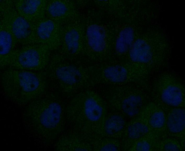 MCU Antibody in Immunocytochemistry (ICC/IF)