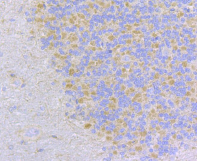 MCU Antibody in Immunohistochemistry (Paraffin) (IHC (P))