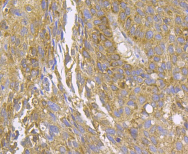 MCU Antibody in Immunohistochemistry (Paraffin) (IHC (P))