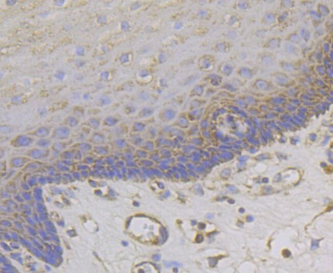 MCU Antibody in Immunohistochemistry (Paraffin) (IHC (P))