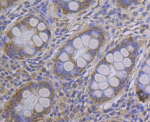 MCU Antibody in Immunohistochemistry (Paraffin) (IHC (P))