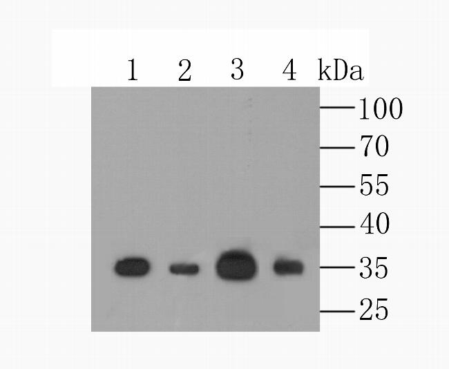 MCU Antibody in Western Blot (WB)