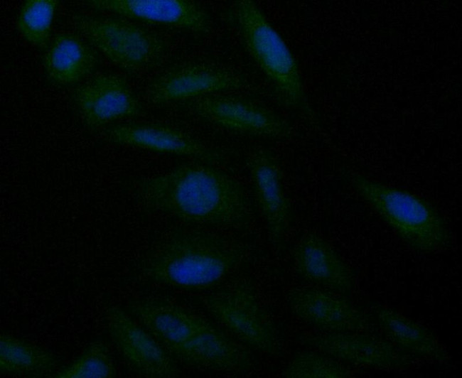 alpha Actinin 1 Antibody in Immunocytochemistry (ICC/IF)