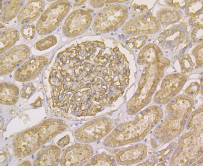 alpha Actinin 1 Antibody in Immunohistochemistry (Paraffin) (IHC (P))