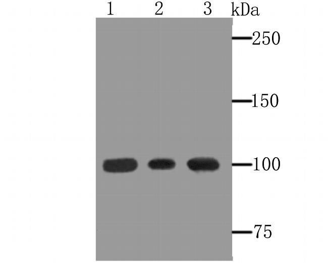 alpha Actinin 1 Antibody in Western Blot (WB)