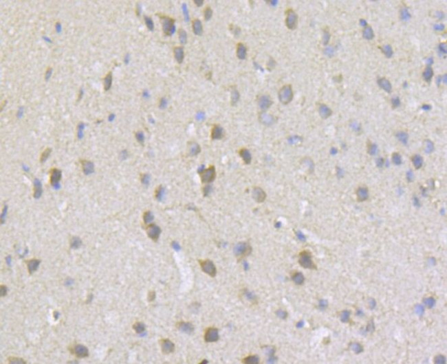 gamma-ENaC Antibody in Immunohistochemistry (Paraffin) (IHC (P))