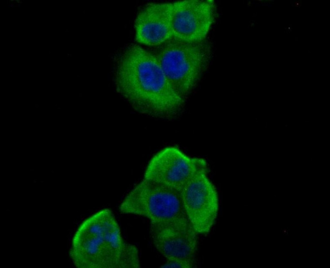 Nephrin Antibody in Immunocytochemistry (ICC/IF)