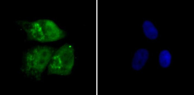 RAD21 Antibody in Immunocytochemistry (ICC/IF)