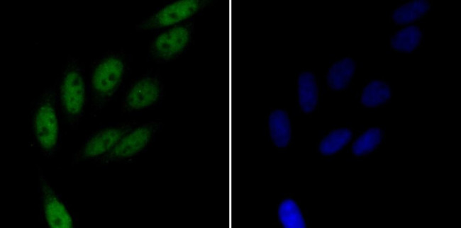 RAD21 Antibody in Immunocytochemistry (ICC/IF)