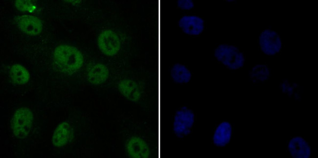 RAD21 Antibody in Immunocytochemistry (ICC/IF)