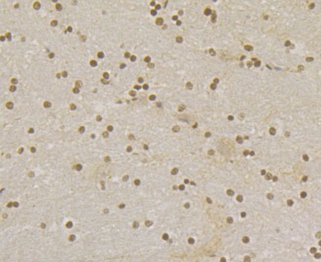 RAD21 Antibody in Immunohistochemistry (Paraffin) (IHC (P))