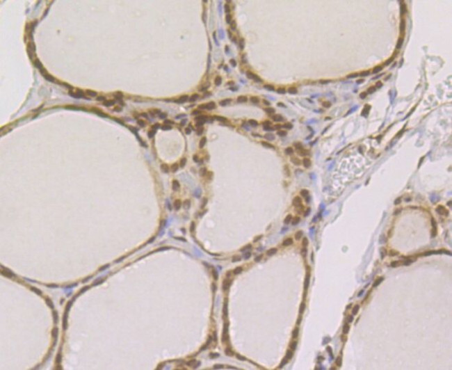 RAD21 Antibody in Immunohistochemistry (Paraffin) (IHC (P))