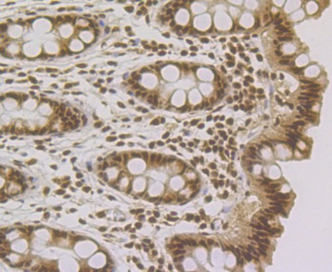 RAD21 Antibody in Immunohistochemistry (Paraffin) (IHC (P))