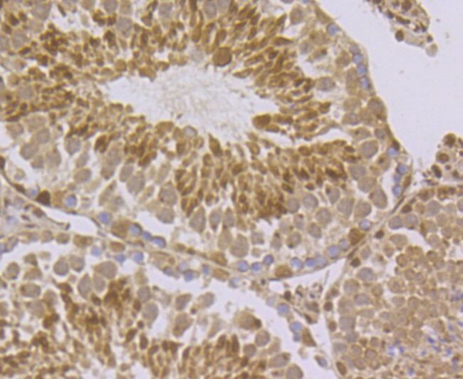 RAD21 Antibody in Immunohistochemistry (Paraffin) (IHC (P))