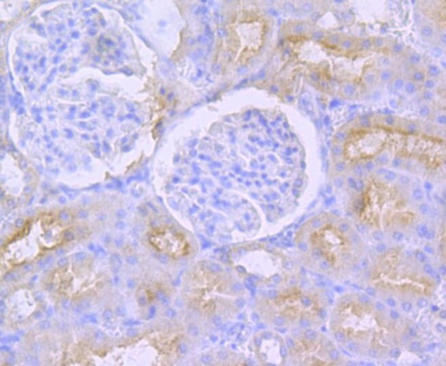 CD13 Antibody in Immunohistochemistry (Paraffin) (IHC (P))