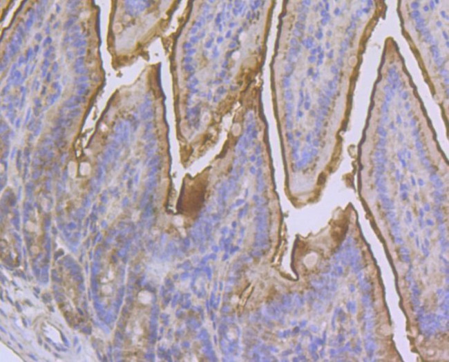 CD13 Antibody in Immunohistochemistry (Paraffin) (IHC (P))