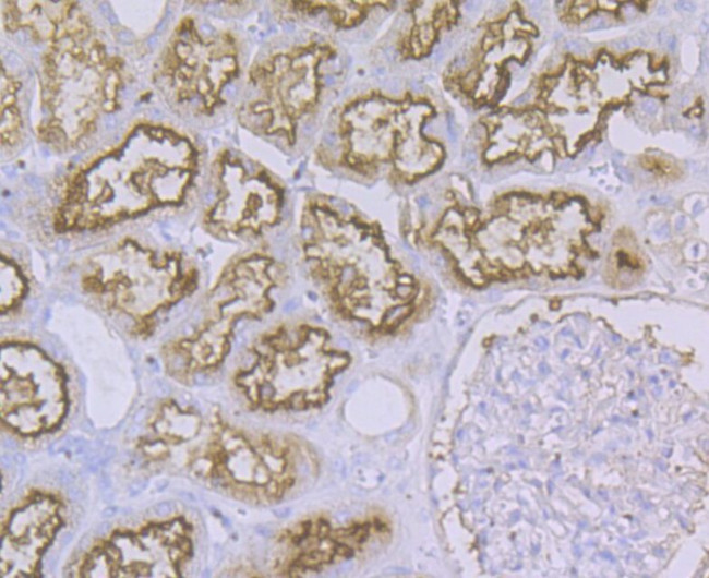 CD13 Antibody in Immunohistochemistry (Paraffin) (IHC (P))