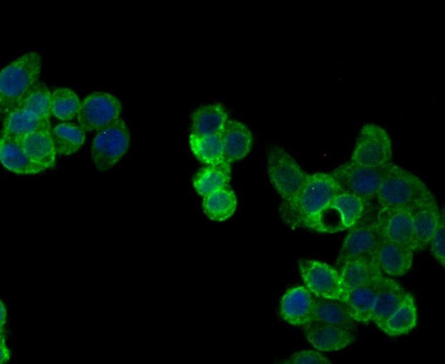 Perforin Antibody in Immunocytochemistry (ICC/IF)