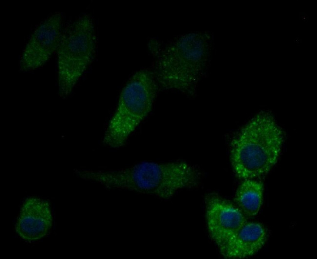 Perforin Antibody in Immunocytochemistry (ICC/IF)