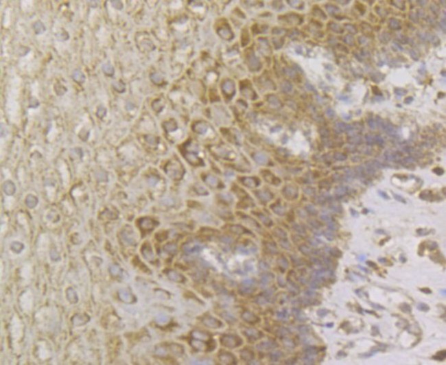 Perforin Antibody in Immunohistochemistry (Paraffin) (IHC (P))