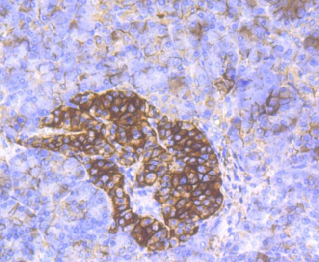 CD99 Antibody in Immunohistochemistry (Paraffin) (IHC (P))