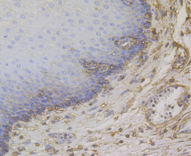 CD99 Antibody in Immunohistochemistry (Paraffin) (IHC (P))