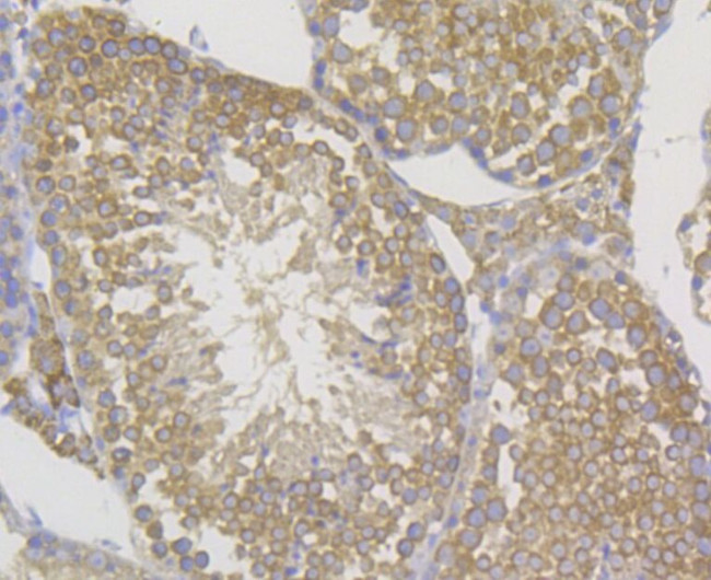 CD99 Antibody in Immunohistochemistry (Paraffin) (IHC (P))