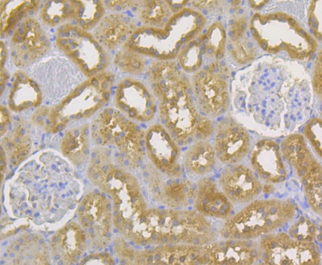 CD99 Antibody in Immunohistochemistry (Paraffin) (IHC (P))