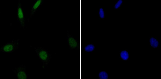 GPR30 Antibody in Immunocytochemistry (ICC/IF)